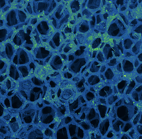 TEM image of multifunctional nanostructures (green) coated on a sponge for environmental remediation.